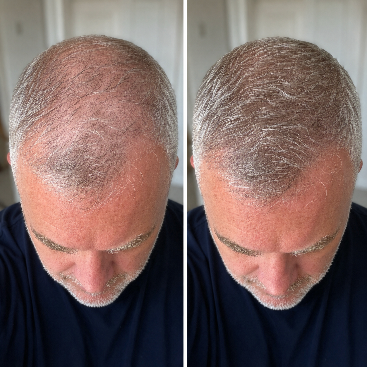 Before and after — James W.