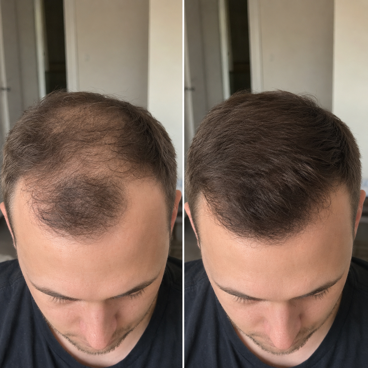 Before and after — Alex T.