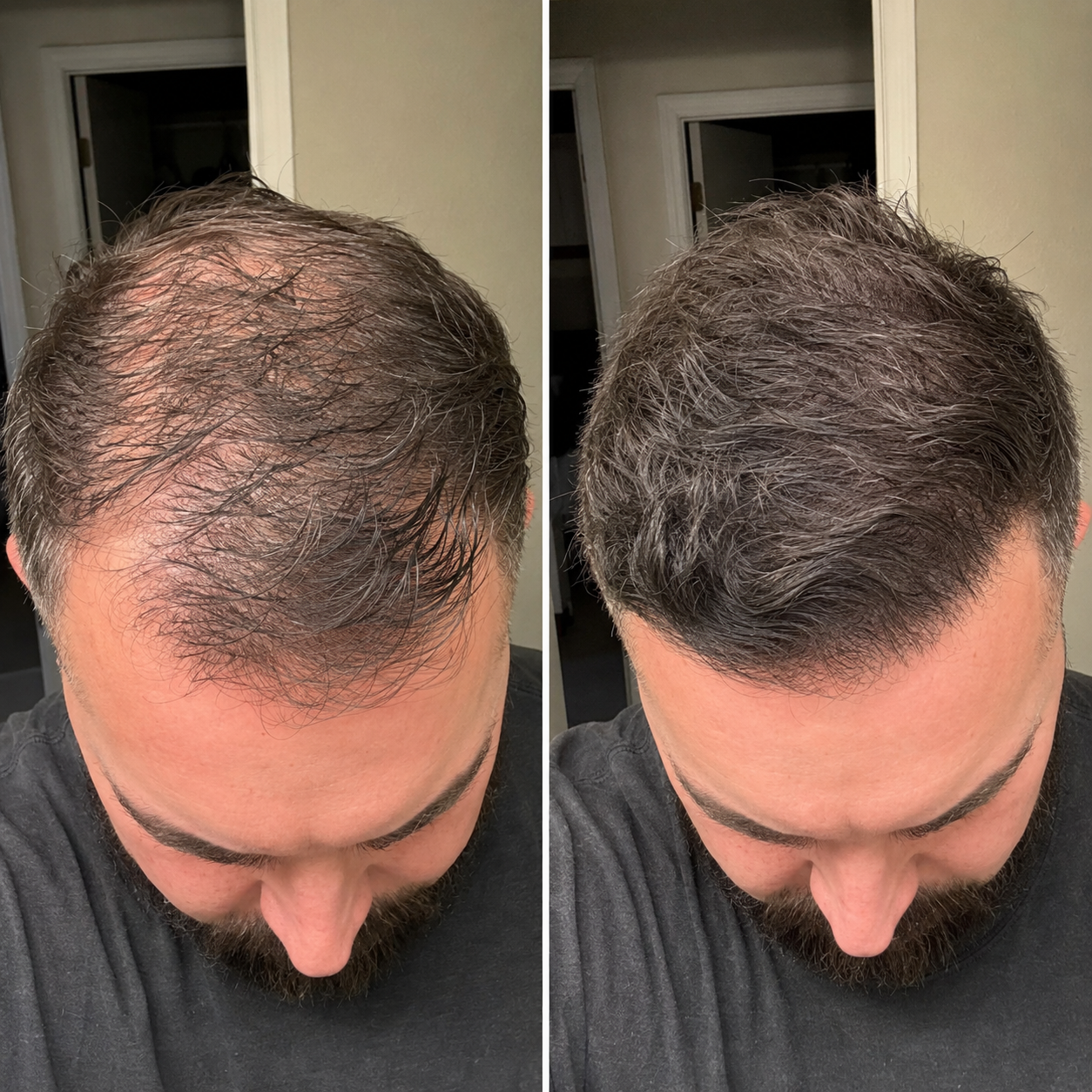 Before and after — Ryan K.